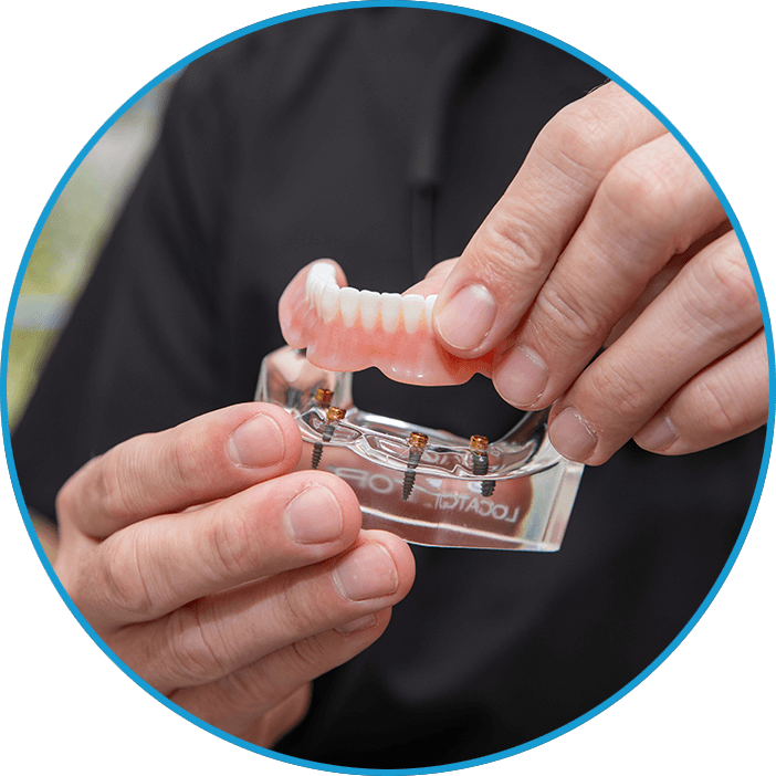 all on x dr loftin full arch