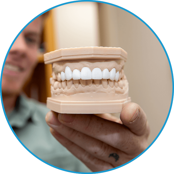 dental bridge loftin real