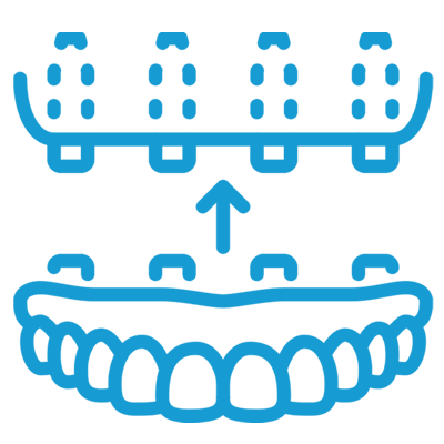 full arch implant icon