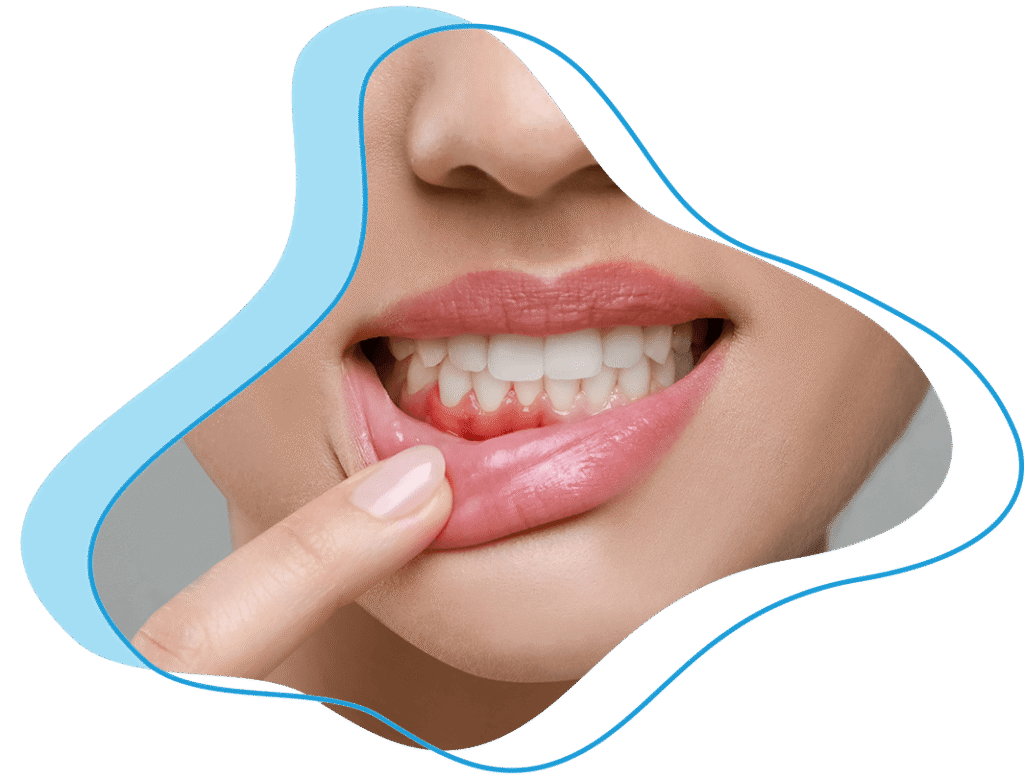 lady shows gum disease issues