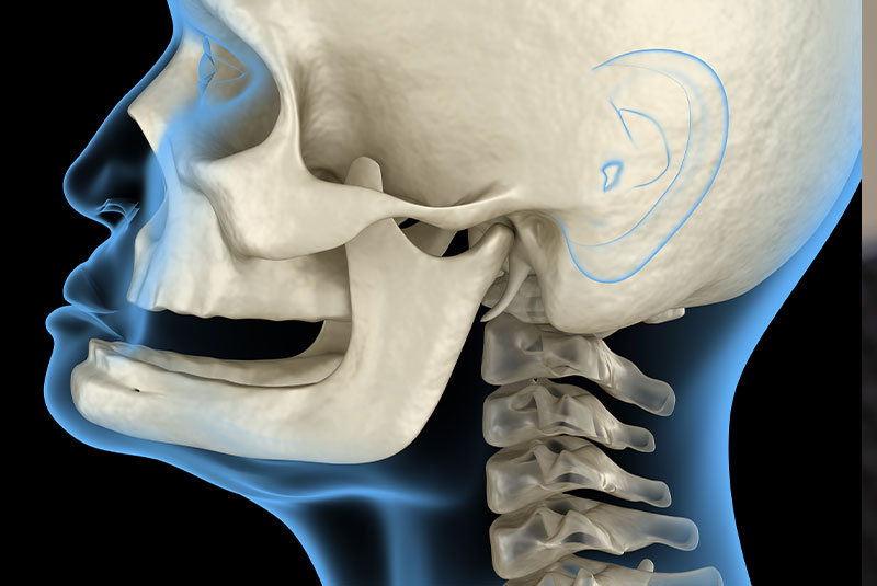3d model of sunk in face bone loss