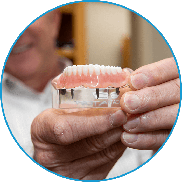 man holding full arch dental implant